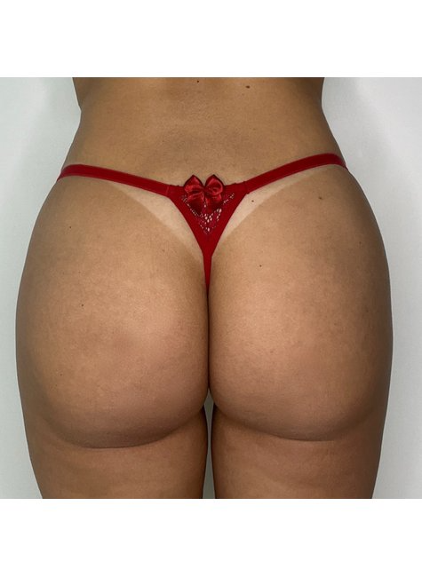 Kit com 6un - Calcinha Fio Anita